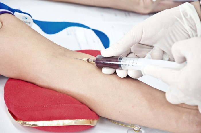 Allergy blood testing