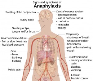 Anaphylaxis symptoms
